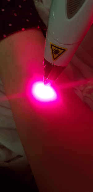 laserterapia pós parto